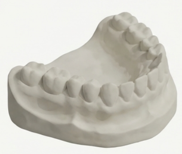 과거 석고 모형