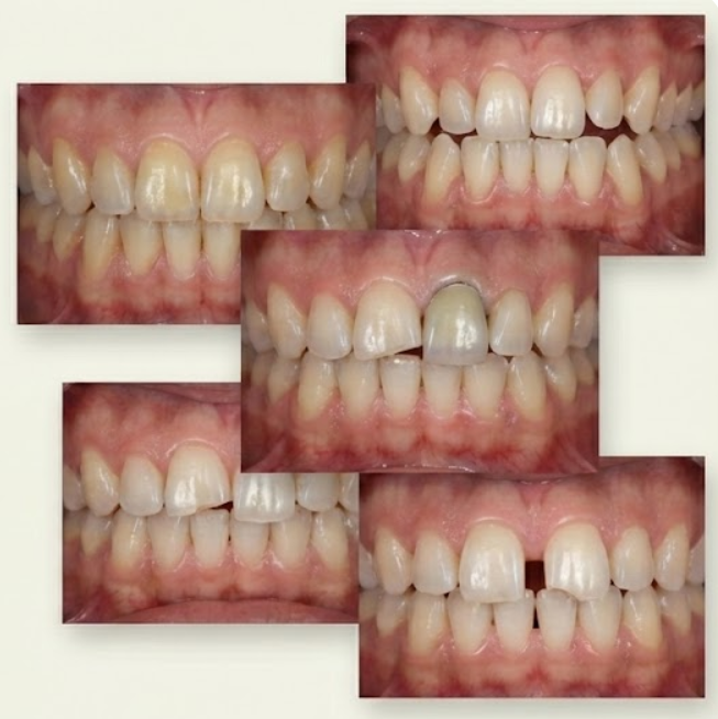 다양한 치아 고민